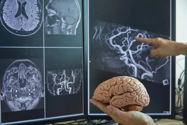 Human brain model on doctor hand. Neurologist demonstrating brain MRI on computer monitor.